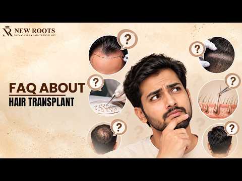 Thinking About a Hair Transplant? WATCH This First! 😳 | Hair Transplant FAQs | Doctor Answers