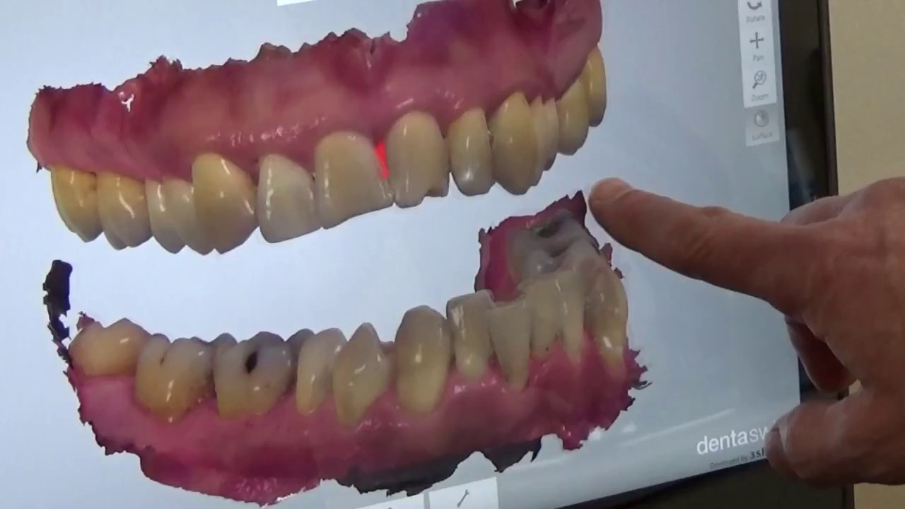 Abingdon Smiles   Mar 1 2017 Commercial