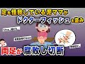 【泥ママ】足を怪我している泥ママがドクターフィッシュを盗んだ結果、両足が大変なことに...【伝説のスレ】