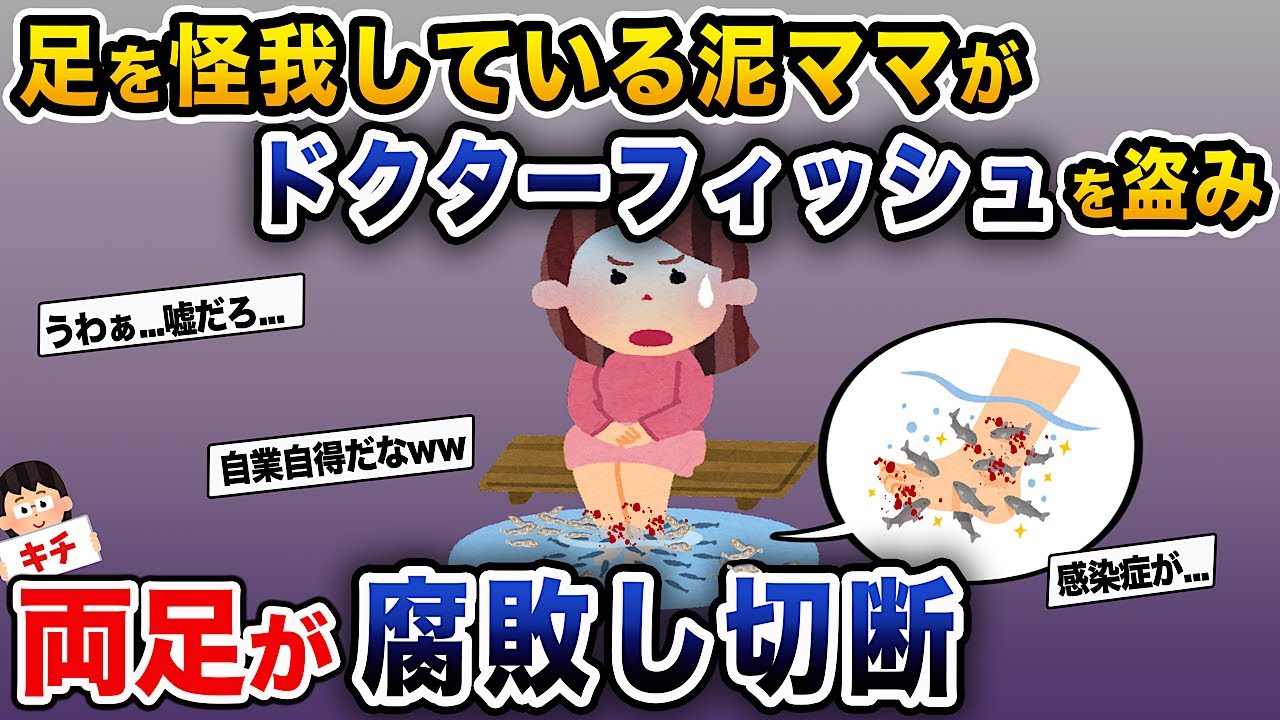 【泥ママ】足を怪我している泥ママがドクターフィッシュを盗んだ結果、両足が大変なことに...【伝説のスレ】