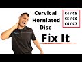 Cervical herniated disc exercises