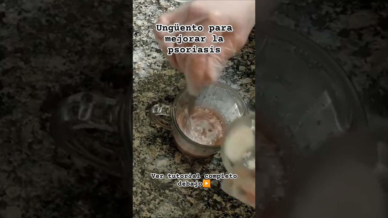 Elaborando UNGÜENTO para tratar la PSORIASIS 