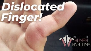 WATCH: Relocating My Patient's Finger