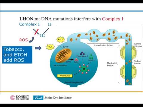 Video: Syklosporin A Forhindrer Ikke Andre øyne Involvering I Lebers Arvelige Optiske Nevropati