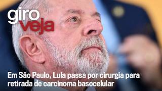 Lula passa por cirurgia para retirada de carcinoma basocelular | Giro VEJA