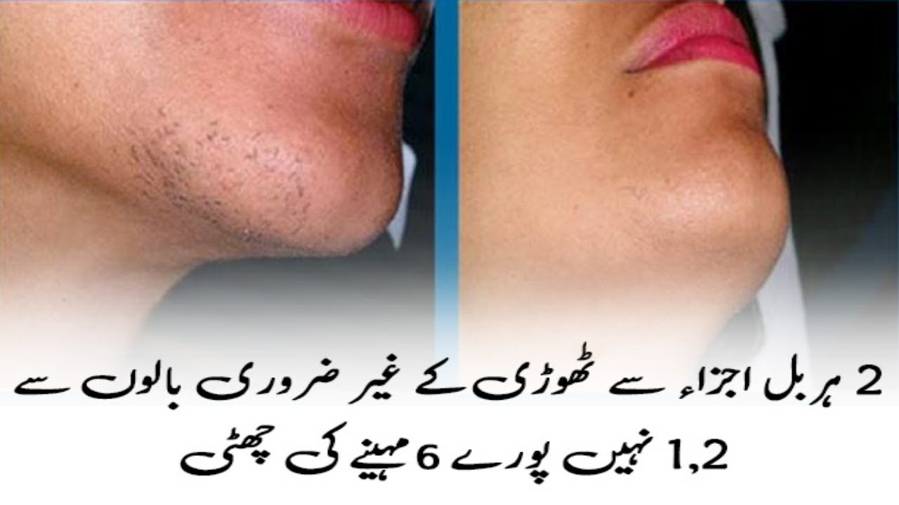 How to Remove Female Chin Hair Tips To Remove Female Chin Hair hindi