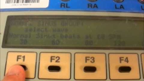 Defibrillator Part XV:  Alarm Delay Test