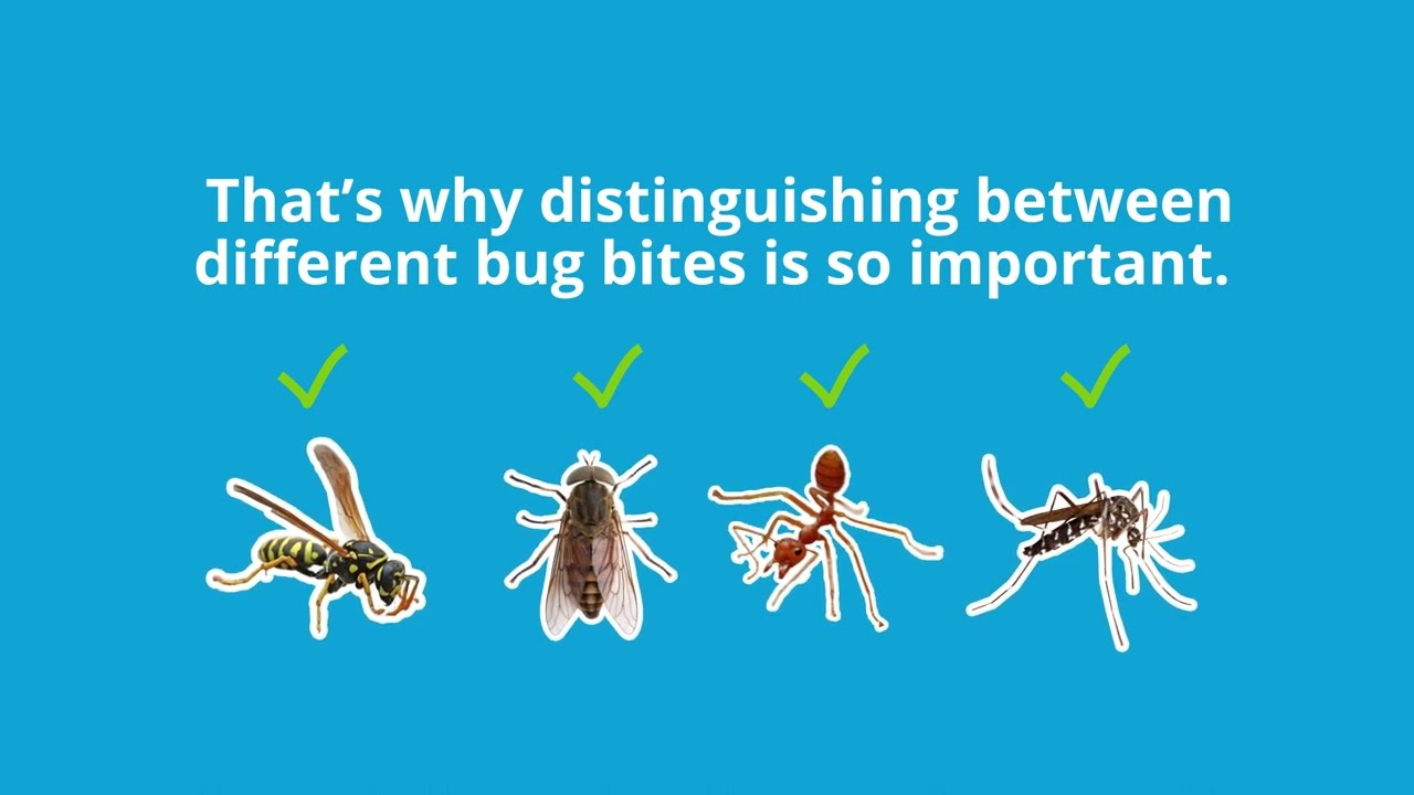 Carolina Pest, What Bug Bit Me? Identify & Treat Bug Bites