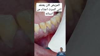 يا جماعه ارجوكم افهمو ان جير الاسنان ليس من اجزاء الاسنان.. ما هو الا بقايا اكل متكلسة على الاسنان