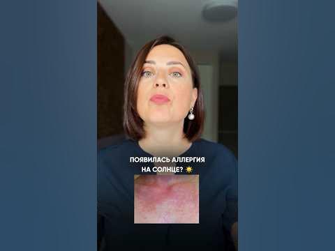 Аллергия на солнце. Как помочь? (В комментарии) - YouTube