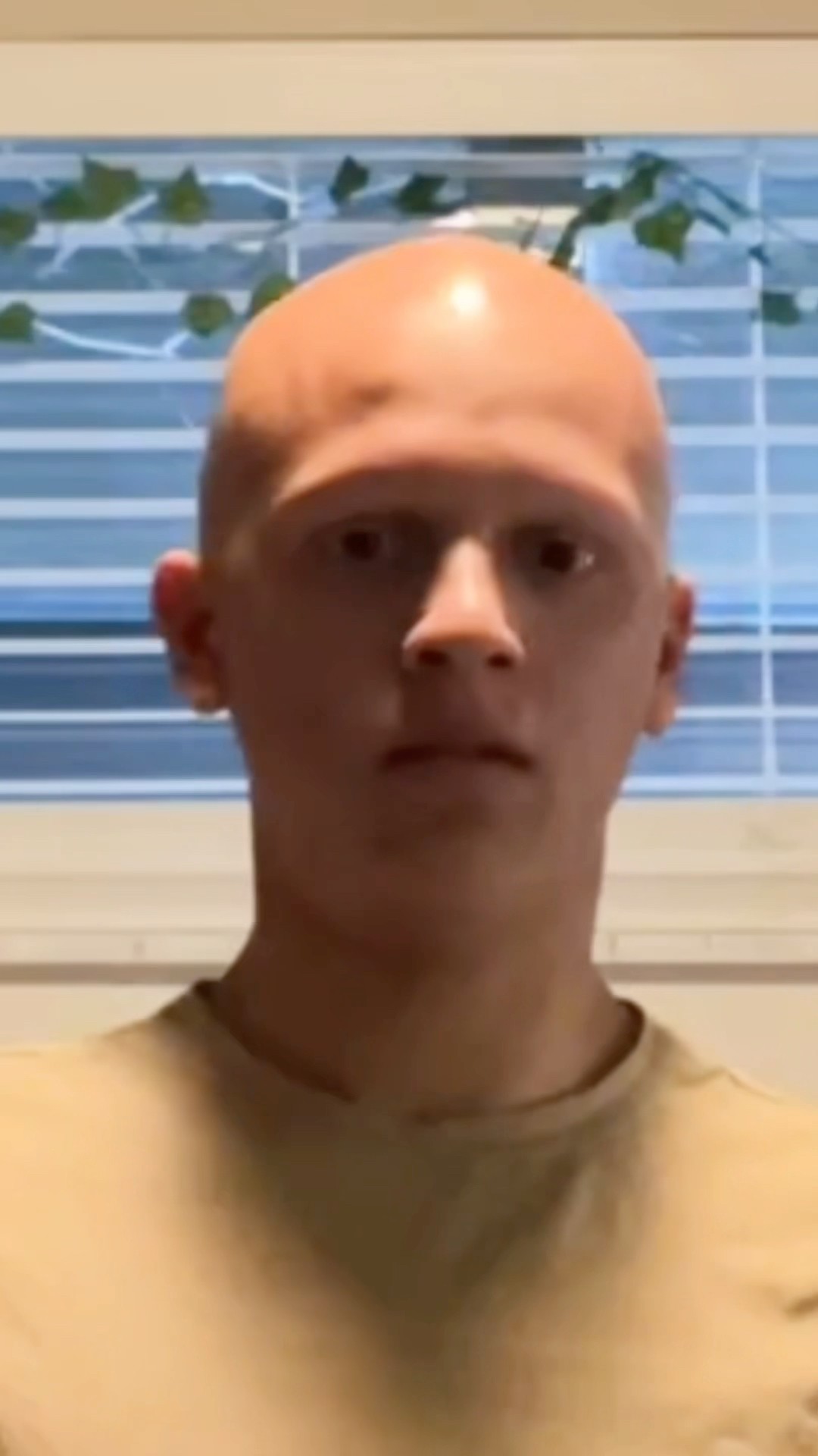 HELIKOPTER HELIKOPTER ?? #comedy #funny #lol #alopecia