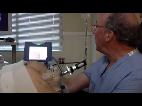 Overview  of Urologix BPH Therapies