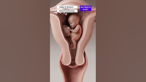 Baby in breech position