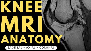 Knee MRI Anatomy | Radiology anatomy part 1 prep | How to interpret a knee MRI screenshot 3