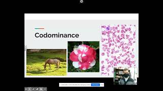 4-Unit 6: Genetics-Part 4: Codominant Inheritance Patterns