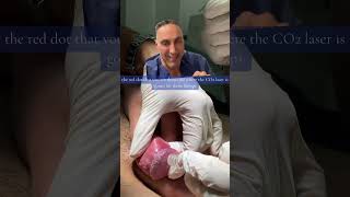 Ppp Treatment With Co2 Laser - Pearly Penile Papules Removal - Ppp Treatment On