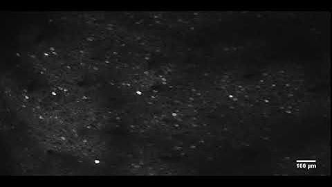 GCaMP6f calcium Imaging in the mouse cortex L2/3, timelapse of 20min