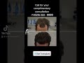 Best Before and After FUE Hair Transplant LA, Los Angeles, Beverly Hills, San Francisco, Pasadena