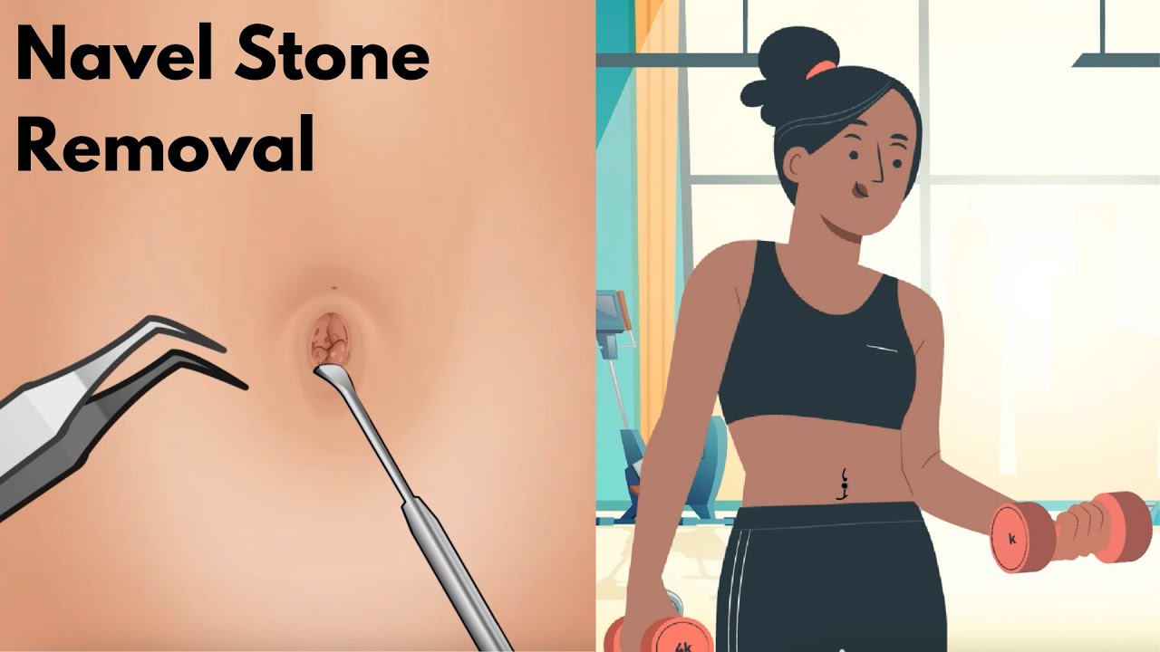 ASMR Animation: Dirt And Navel Stone Removal - YouTube