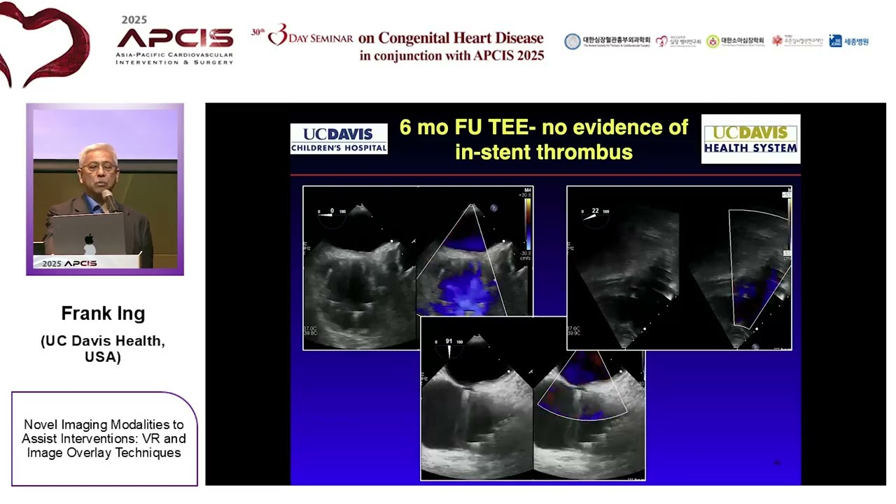 Новые методы визуализации для содействия вмешательствам: виртуальная реальность и методы наложени...