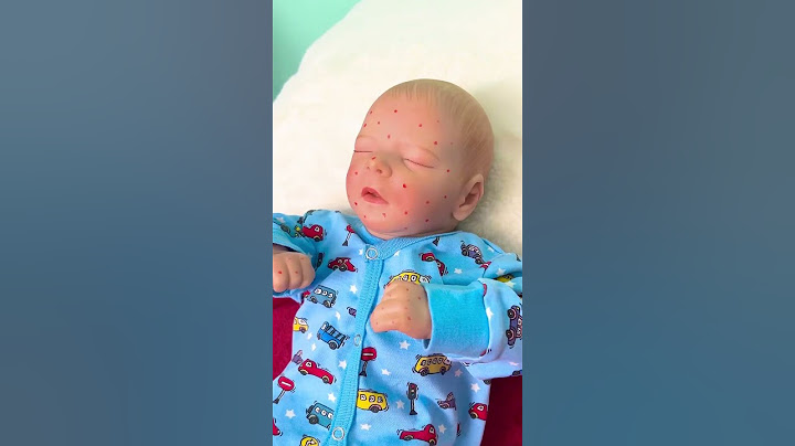 Smart Parenting Trick to Keep Mosquitoes Away! 🦟👶 #parenting #hacks #tips