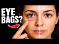 Puffy Eyes and Face? Do This for 30 Seconds | Dr. Mandell