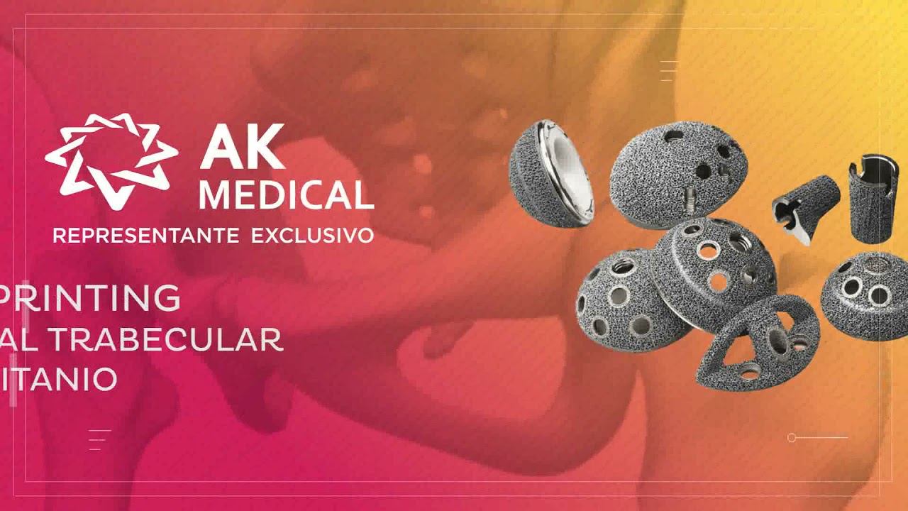 Bioadvance · Líneas de Implantes AK Medical para Cadera - YouTube