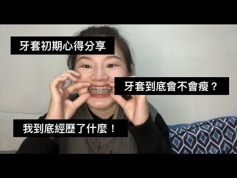 ［三倍頌］牙套初期大分享！我到底經歷了什麼！戴牙套到底會不會瘦？