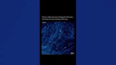 Your Brain Is a Whole Universe 🌌 | Neurons Firing Inside #shorts