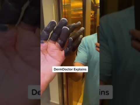 Video: Dead Man's Finger Control - Cum arată degetele Dead Man's Fingers