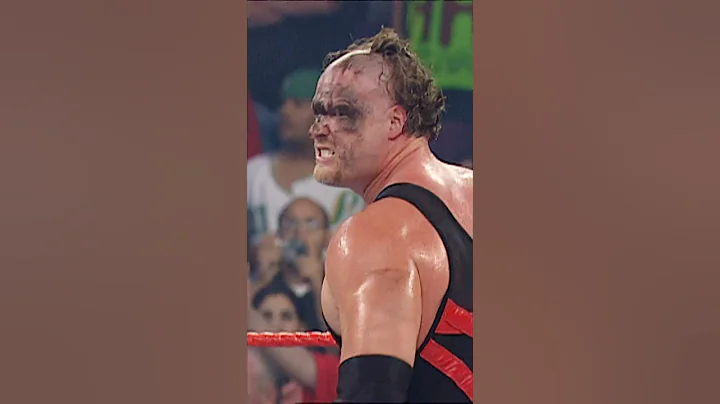 Kane unmasks for the first time