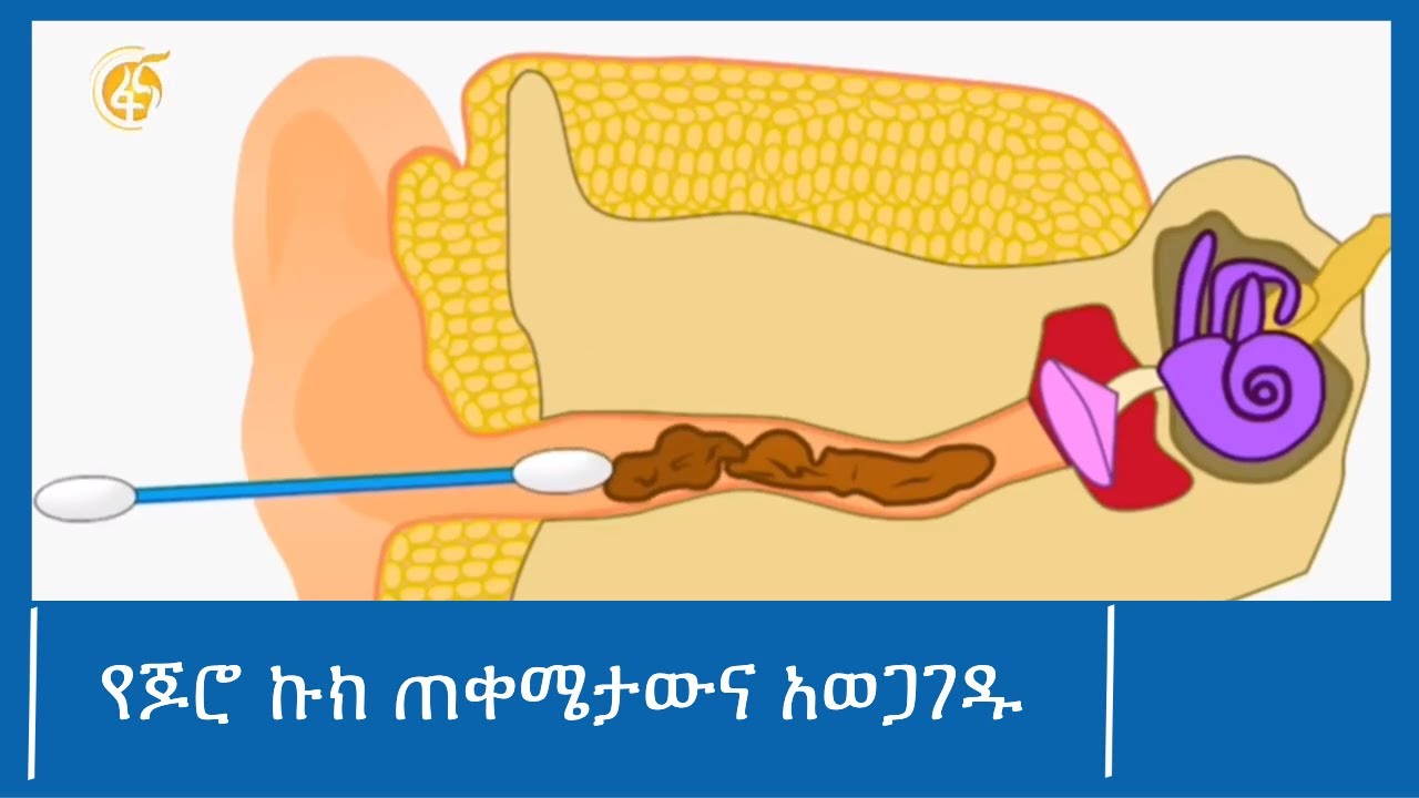 የጆሮ ኩክ ጠቀሜታውና አወጋገዱ