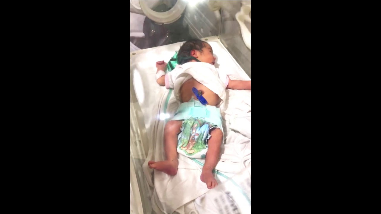 Gestational Age Assessment. Pediatric OSCE.