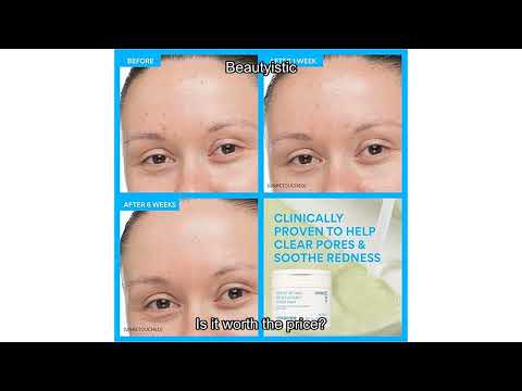 Innisfree Daily Gentle Retinol Salicylic Toner Pads Review: Does It Really Calm Acne-Prone Skin?