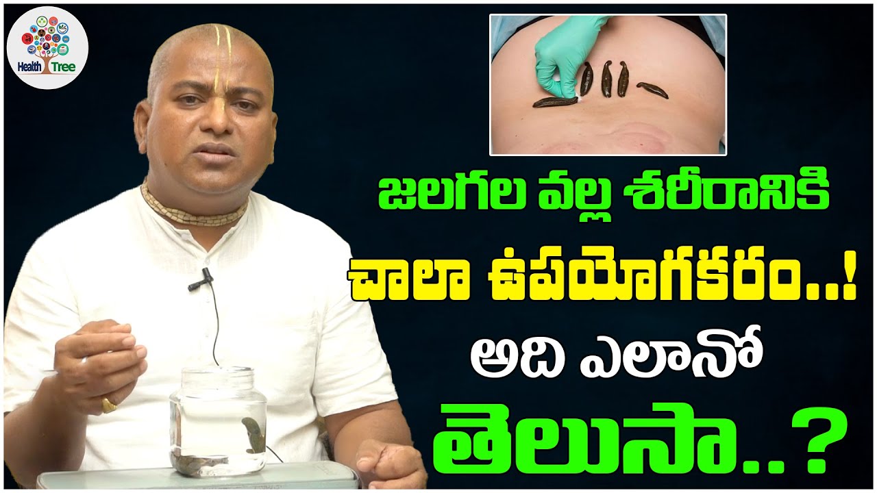 Leech Therapy For Blood circulation | Leech Therapy in Telugu| Dr.Gummadavelli Srinivas Ayurvedam-HT