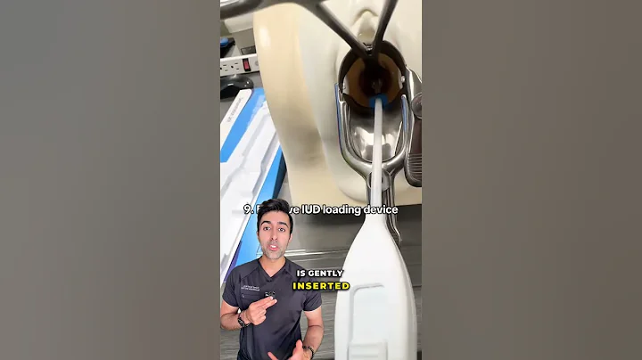 This Is What Happens During an IUD Insertion