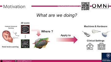 AdLocUI: Adaptive 3D Localization of 2D Freehand Ultrasound Brain Images (MICCAI 2022)