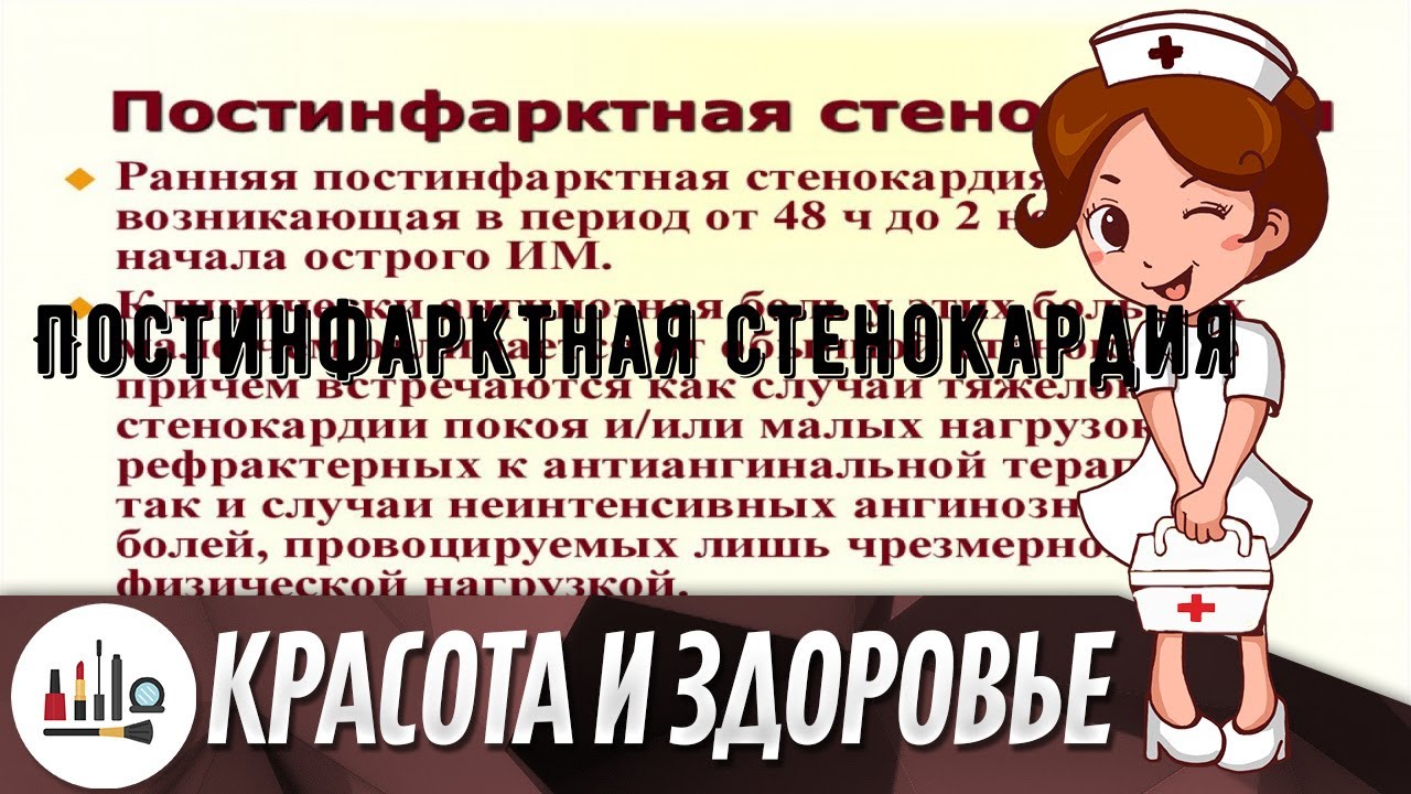 Постинфарктная стенокардия