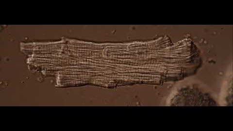 Time-Lapse: Isolated Murine Cardiomyocyte by Dr. Christopher B. Jackson