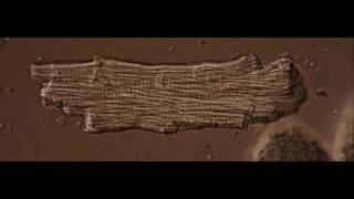Time-Lapse: Isolated Murine Cardiomyocyte by Dr. Christopher B. Jackson