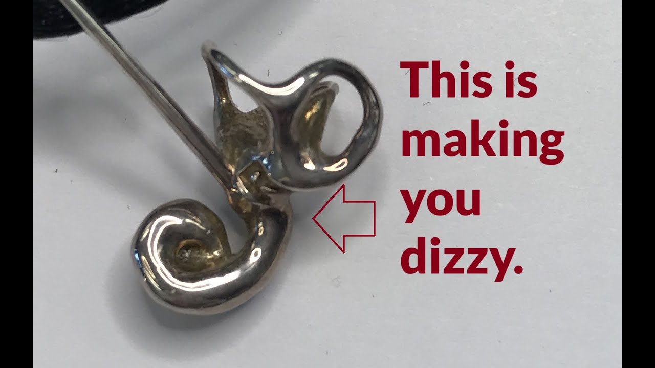 Is your otolith causing your dizziness?