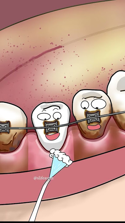 How to clean teeth 😊 #asrm #shorts