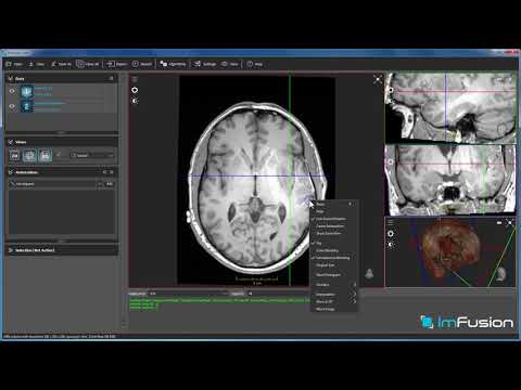 Loading and Visualizing Medical Image Data using ImFusion Suite