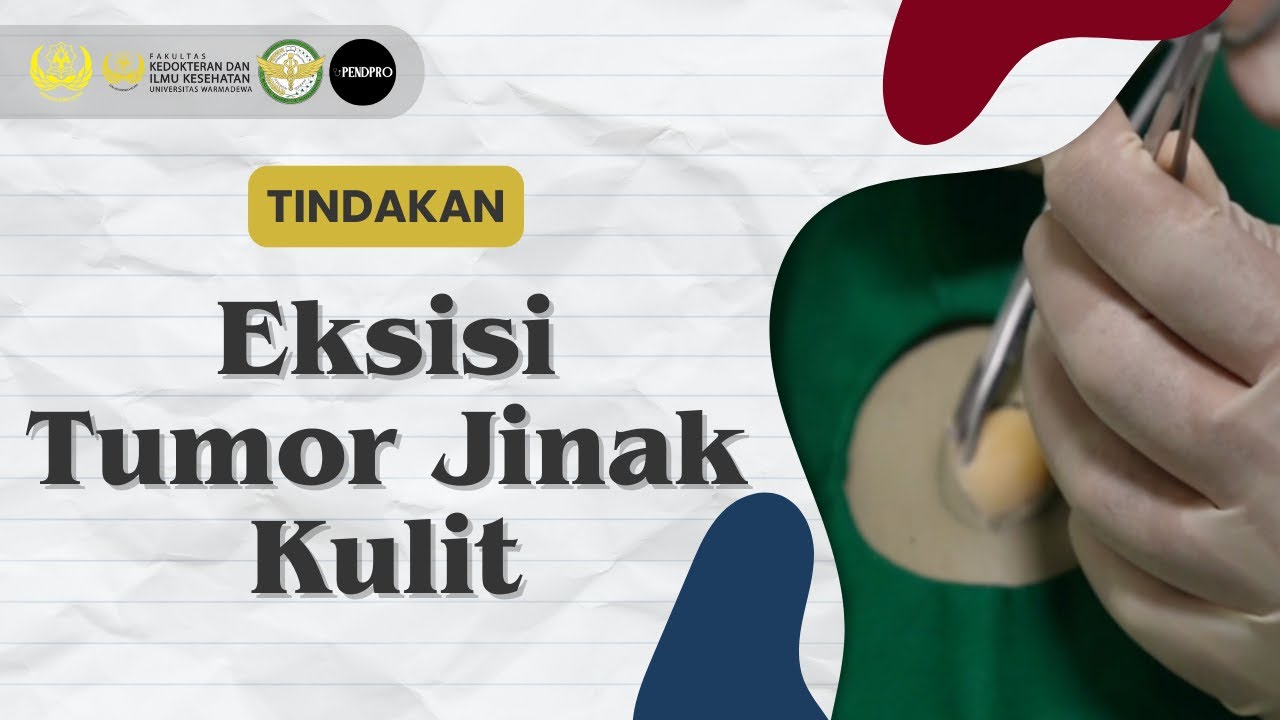 BENIGN SKIN TUMOR EXCISION