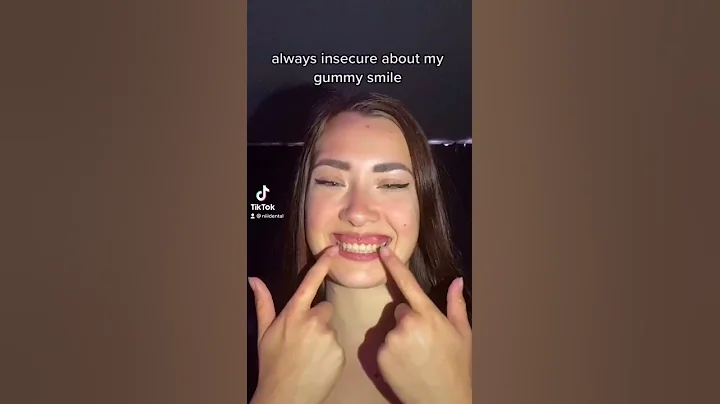 Best Gummy Smile Fix?! #shorts