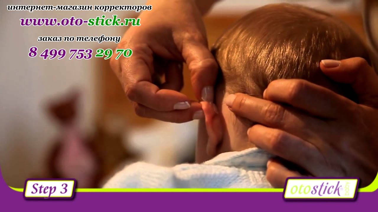 Отостик Бейби (Otostick Baby) корректор ушей для детей YouTube