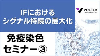 【Part3】IFにおけるシグナル持続の最大化　動画