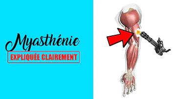 Quels sont les symptômes de la myasthénie ?