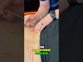 The Best Low Back Pain Treatment? Dry Needling!