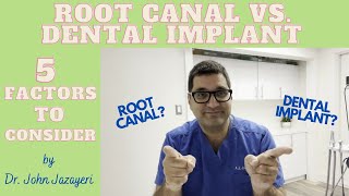 Root Canal vs. Dental Implant: Which One Do You Need?